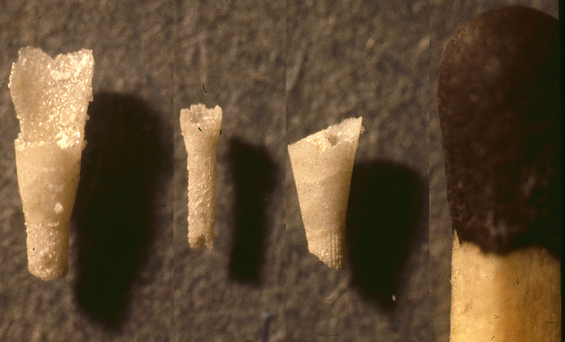 Echinothuria? sp. Dania