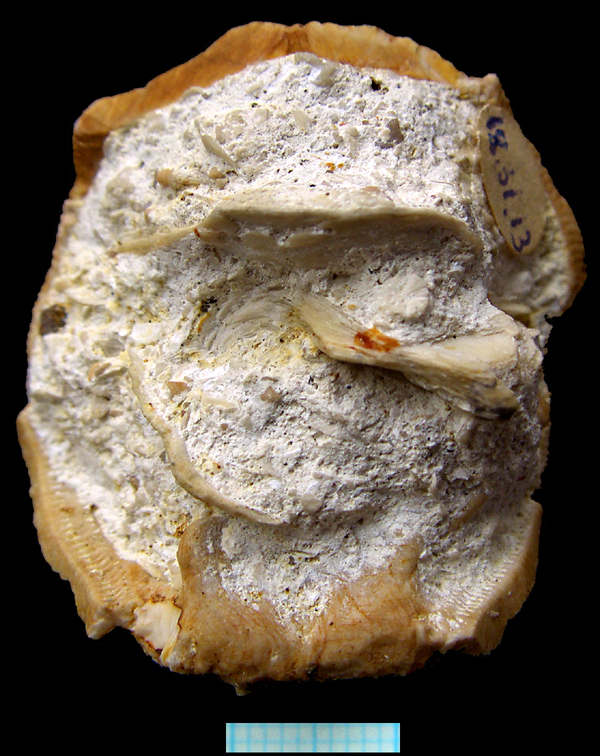 Stereocidaris sp.